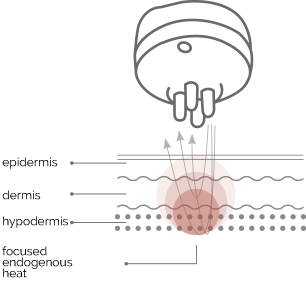 <span>20 minutes</span> treatment