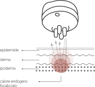 Trattamento di 20 minuti