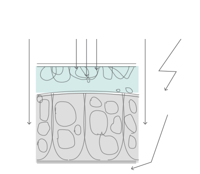 VRF™ VARIABLE RADIOFREQUENCY