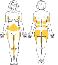 TREATMENT AREAS FOR WOMEN