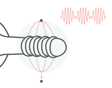 Interferential sine wave electrostimulation